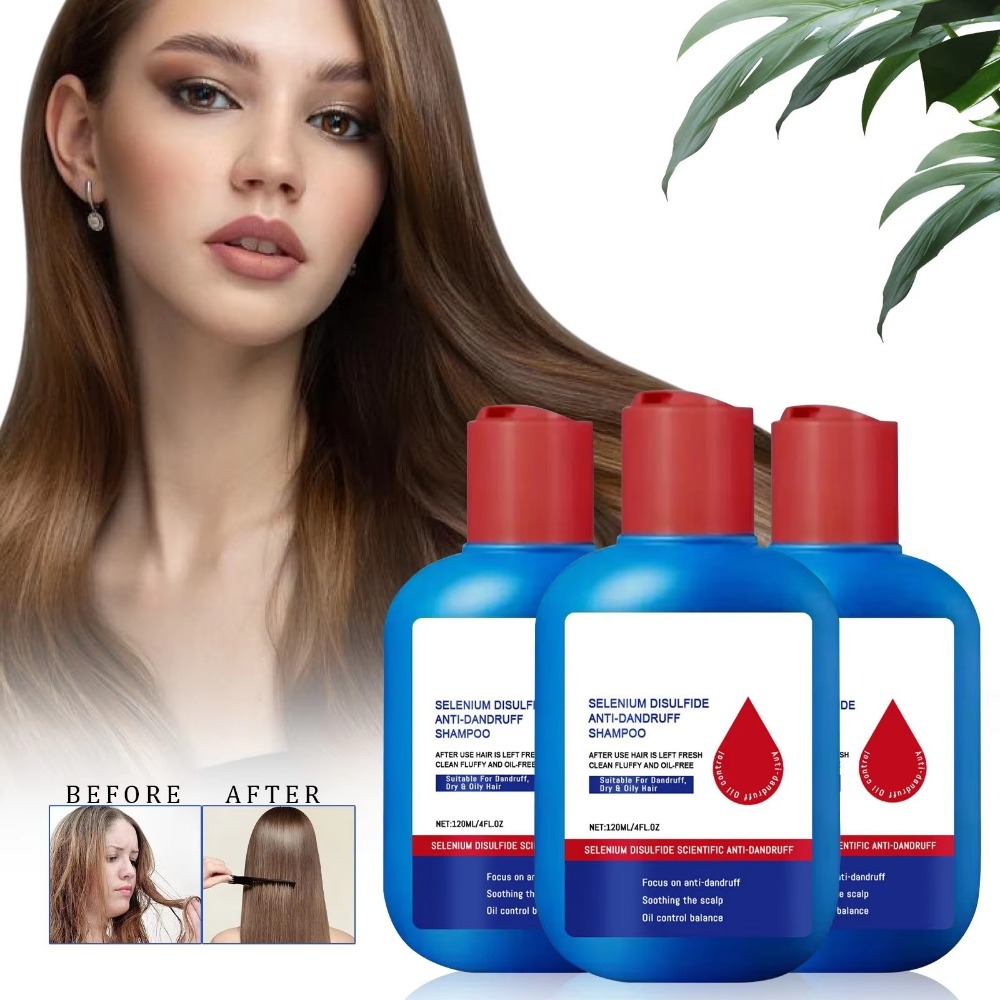 Nuovo Shampoo Nipori 120ml per - Hair Care Dandruff recensione e prezzo